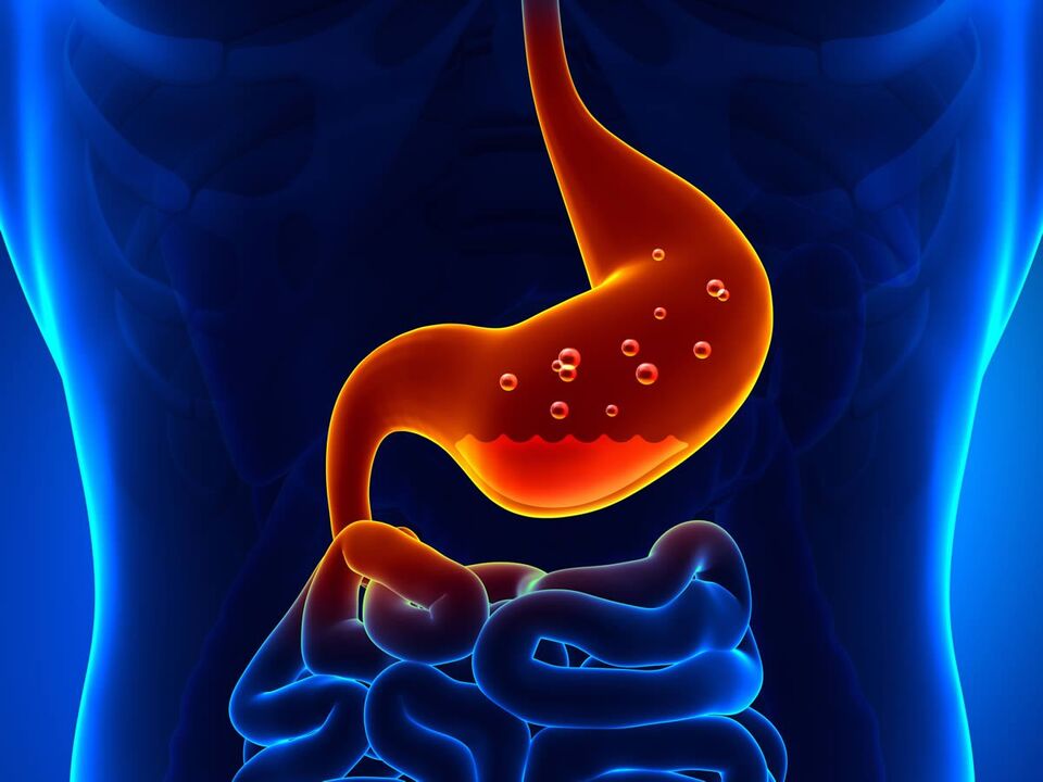 Gastritis des Magens